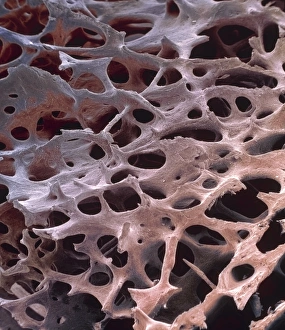 Images Dated 13th March 2002: Spongy bone, SEM