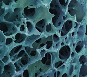 Images Dated 13th March 2002: Spongy bone, SEM
