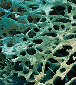 Images Dated 13th March 2002: Spongy bone, SEM
