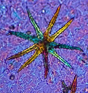 Stellate plant hair, light micrograph
