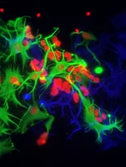 Stem Cell Gallery: Stem cell-derived astrocyte brain cells