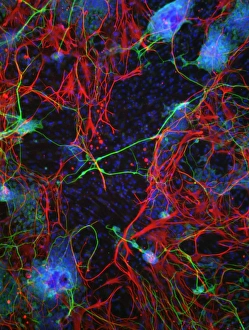 Nuclei Gallery: Stem cell-derived nerve cells