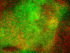 Nuclei Gallery: Stem cell-derived retinal cells