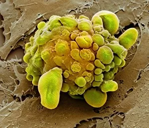 Differentiation Gallery: Stem cell dying, SEM