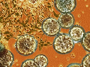 Differentiation Gallery: Stem cells, light micrograph