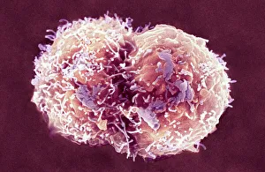 Stem Cell Gallery: Stem cells, SEM
