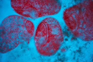 Fluorescence Micrograph Gallery: Stentor ciliate protozoa light micrograph