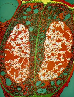Stoma of a pea leaf Stoma of a pea leaf