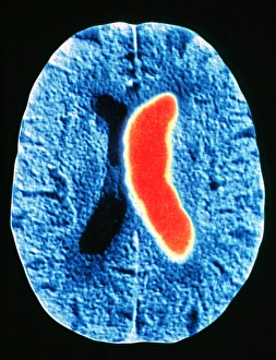 Stroke Stroke