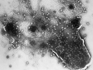 Images Dated 25th May 1985: TEM of bacterial lysis due to T4 phage infection