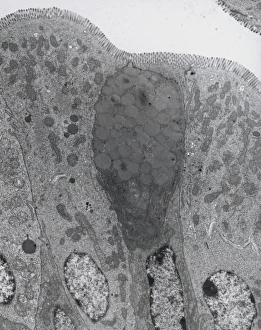 TEM of goblet and secretory cells in duodenum TEM of goblet and secretory cells in duodenum