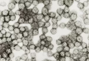 TEM of HIV-antigen AIDS vaccine from yeast