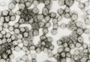 TEM of HIV-antigen AIDS vaccine from yeast TEM of HIV-antigen AIDS vaccine from yeast