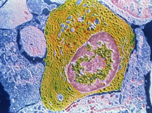 TEM of human plasmocyte TEM of human plasmocyte