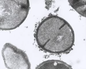 Images Dated 18th October 2002: TEM of Staphylococcus aureus bacteria