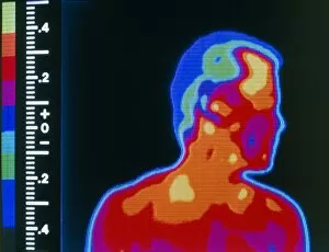 Images Dated 3rd February 2005: Thermogram of head & shoulders of a man