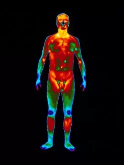 Thermogram of a standing naked man (front view)