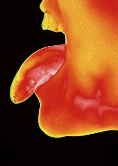 Thermogram of a woman sticking her tongue out Thermogram of a woman sticking her tongue out