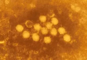 Tinted TEM of coxsackievirus particles