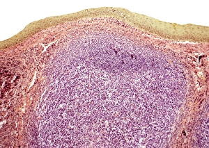 Immune System Cells Prints: Tonsil, light micrograph