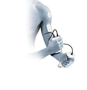 Transdermal drug delivery Transdermal drug delivery