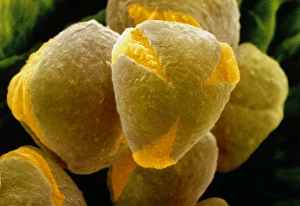 Tricolporate pollen of rose flower Tricolporate pollen of rose flower
