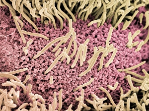 Images Dated 17th January 2005: Underside of a slug, SEM