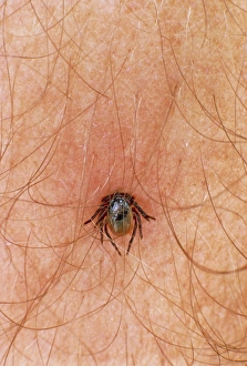 Unidentified tick feeding on human blood Unidentified tick feeding on human blood