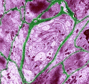 Unmyelinated intestinal nerve fibre, TEM Unmyelinated intestinal nerve fibre, TEM