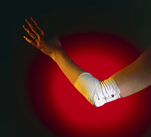 View of a bandaged elbow View of a bandaged elbow