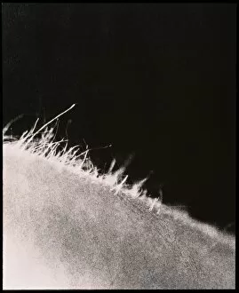 Images Dated 12th March 1999: View of hairs on the arm of a woman