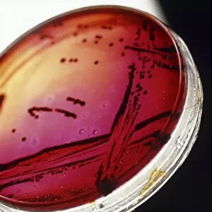 View of a petri dish with bacterial cultures