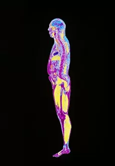 Images Dated 10th November 1995: Visible Human Project: sectioned male body (side)