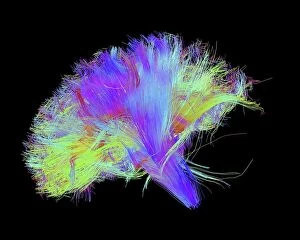 Pathways Gallery: White matter fibres of the human brain C014 / 5666