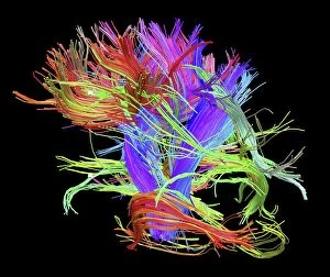 Nervous System Gallery: White matter fibres of the human brain C014 / 5667