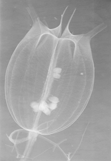X-ray of an unidentified flower pod X-ray of an unidentified flower pod