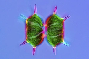 Xanthidium desmids, light micrograph
