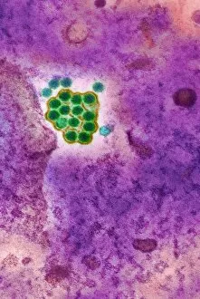 Images Dated 23rd April 2003: Yellow fever virus particles, TEM