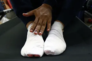 A migrant touches his bandagged feet as he rests inside an improvised shelter in the A migrant touches his bandagged feet as he rests inside an improvised shelter in the