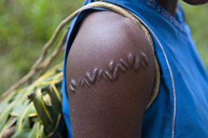 Local girl with typical scar near, Volcano Yasur, Island of Tanna, Vanuatu, South Pacific Local girl with typical scar near, Volcano Yasur, Island of Tanna, Vanuatu, South Pacific