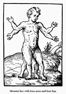 BOY MONSTER, 1573. Boy monster with four arms and four legs BOY MONSTER, 1573. Boy monster with four arms and four legs