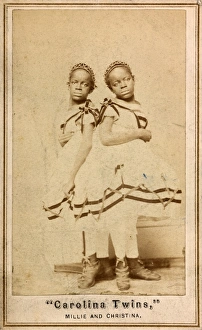 THE CAROLINA TWINS, c1866. Millie and Christine McKoy, American conjoined twins THE CAROLINA TWINS, c1866. Millie and Christine McKoy, American conjoined twins