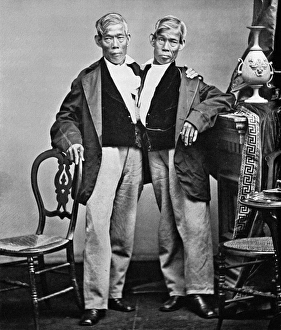 CHANG AND ENG (1811-1874). The original Siamese Twins. Photographed by Mathew Brady CHANG AND ENG (1811-1874). The original Siamese Twins. Photographed by Mathew Brady