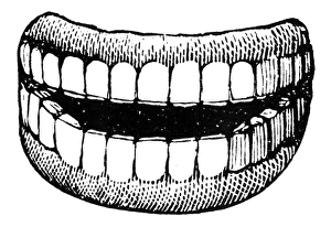 <b class=qtipBold><figcaption>DENTURES, 1900. Line cut</figcaption></b><br>DENTURES, 1900. Line cut.<br><em>© none</em> DENTURES, 1900. Line cut