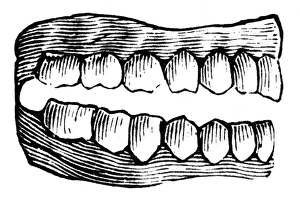 <b class=qtipBold><figcaption>DENTURES, c1900. Line cut</figcaption></b><br>DENTURES, c1900. Line cut.<br><em>© none</em> DENTURES, c1900. Line cut