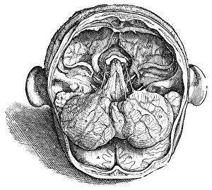 Dissection of the brain (fig. 9). Woodcut from the seventh book of Andreas Vesalius De Humani Corporis Fabrica, Basel, Switzerland, 1543