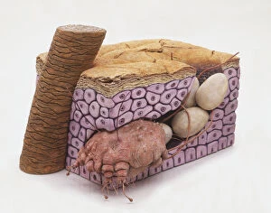 Illustrations 1 Gallery: Cross-section model of Bedbug (Cimicidae) burrowed in skin, laying eggs