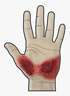 Digital illustration of bleeding wound on palm of hand Digital illustration of bleeding wound on palm of hand