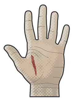 Digital illustration of incised wound on palm human hand Digital illustration of incised wound on palm human hand