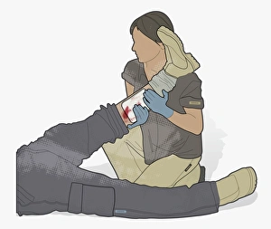 Digital illustration of woman supporting leg of man with burst varicose vein Digital illustration of woman supporting leg of man with burst varicose vein